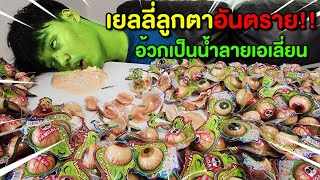 เยลลี่ลูกตาอันตราย‼️ อ้วกเป็นน้ำลายเอเลี่ยน!🤮 อันตรายจากของกินหน้าร้อน🌤