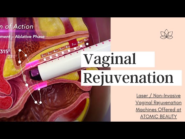 Ogillar onalar bilan porno onlayn Seks porno yalangoch qizlar rasmlar