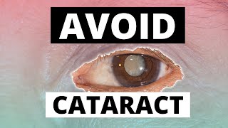 6 Key causes of cataracts and how to prevent it