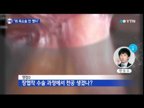 S병원장 "위 축소술 안 했다"...쟁점은? / YTN