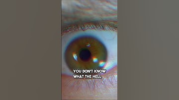 OPTIMALISATIE VAN SCHILDKLIERHORMONEN, Dr. Arvind, C. MD