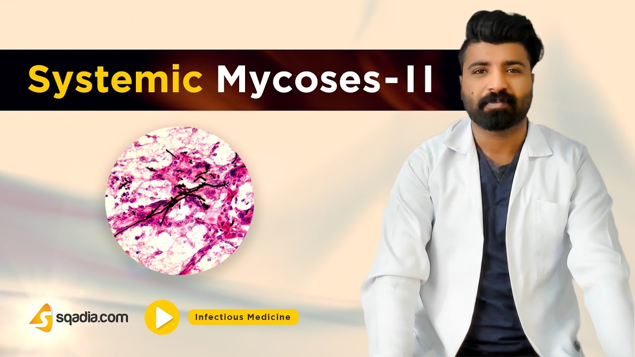 Systemic Mycoses -II | Infectious Medicine Video | Medical Student Lectures | V-Learning