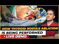 How I Saved Voice Of Singer By Doing Thyroid Nodule Ablation | Dr Gaurav Gangwani (IR)