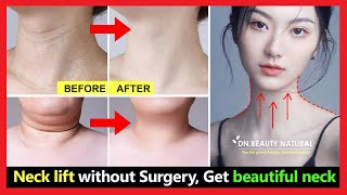 Neck lift without surgery, Get rid of tech neck lines, lose neck fat, fix saggy neck and turkey neck Resimi