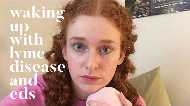 What It's Like Waking Up With Lyme Disease and EDS...