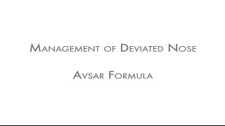 Download Micro-rhinoplasty - Management Of Deviated Nose Video MP3 Micro-rhinoplasty - Management Of Deviated Nose