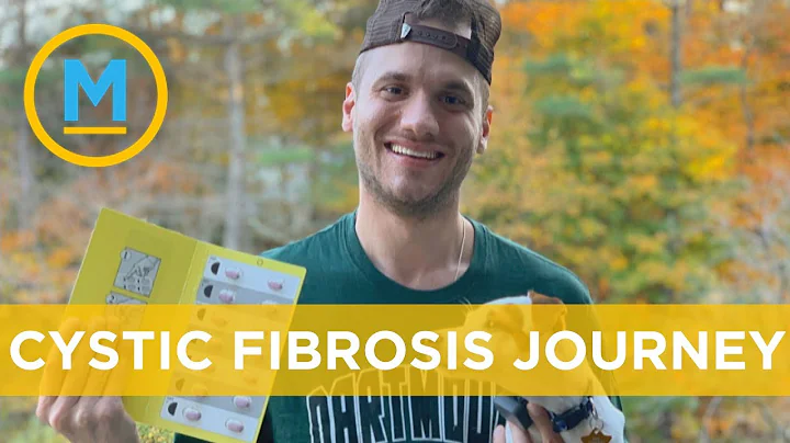 Cystic fibrosis patient shares how new drug changed his life within 10 hours | Your Morning