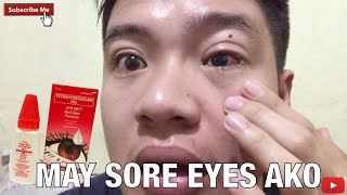 SINTOMAS NG SORE EYES|SIGNS AND SYMPTOMS|GAMOT SA SORE EYES