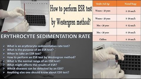 The Blood Test that Predicts Your DEATH l Erythrocyte Sedimentation Rate | ESR Test