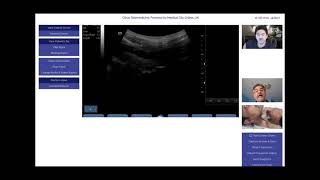 Tele Cardiology - Live Carotid Artery Scanning from a distance using a Telemedicine Innovation.