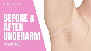 BEFORE AND AFTER UNDERARM WAXING AT PINK PARLOUR