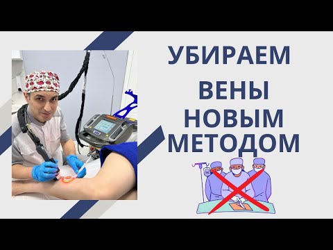 Что такое Клакс и почему он лучше склеротерапии? Флеболог Москва.