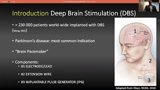 20230222 - Alexandre Boutet - MRI and Deep Brain Stimulation