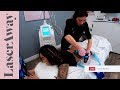 Coolsculpting Flanks aka love handles LIVE SESSION at LaserAway