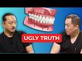 Zirconia Teeth...What they DON&rsquo;T tell you. Full Mouth Dental Implants