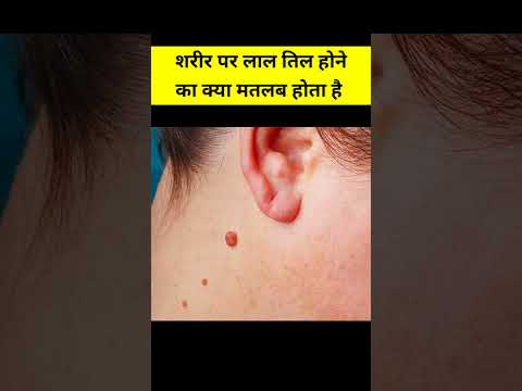 शरीर पर लाल तिल होने का क्या मतलब होता है | #shorts #video #viral #vastushastra