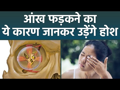 वीडियो: क्या चेहरे का मायोकिमिया दूर होता है?