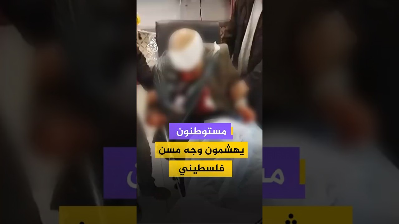 مستوطنون يهشمون وجه مسن فلسطيني
