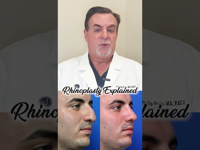 Joseph's Rhinoplasty Explained