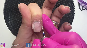 Come sgrassare le unghie dopo il gel?