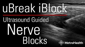 uBREAK iBlock: Ultrasound Guided Nerve Blocks