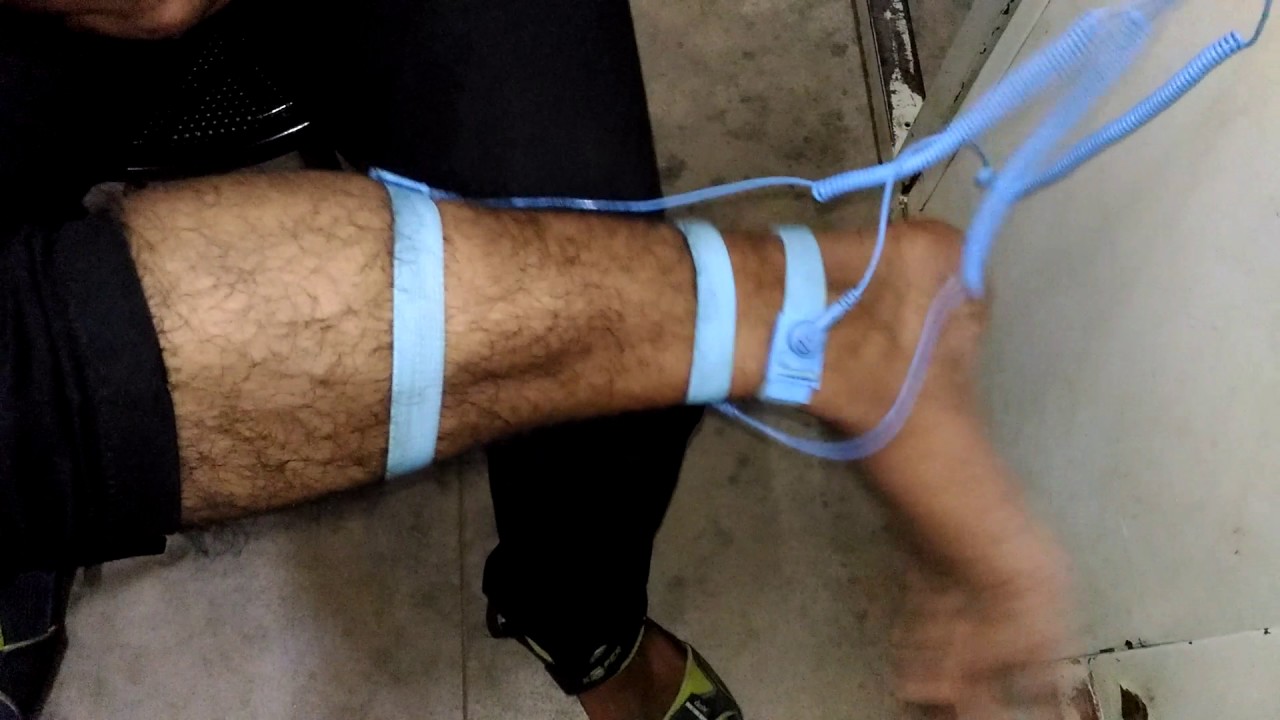 emg testing for lowerback upper leg pain emg testing for lowerback upper leg pain
