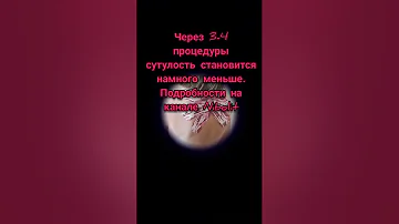 Выровнять человека легко | Кифоз | сколиоз | сутулость |