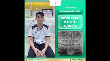 CẢM NHẬN CỦA KHÁCH HÀNG NIỀNG RĂNG MẮC CÀI KIM LOẠI TẠI NHA KHOA ASIA