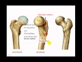 Osteología de miembro inferior 4