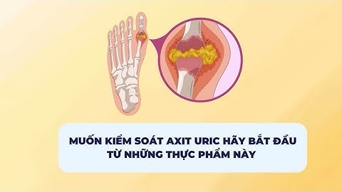Muốn kiểm soát axit uric hãy bắt đầu từ những thực phẩm này | Báo Lao Động