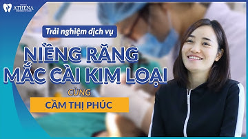 Niềng Răng Mắc Cài Kim Loại I Cầm Thị Phúc  | Nha Khoa Athena