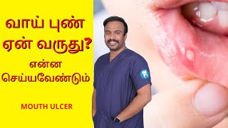 Mouth Ulcer Treatment and Home Remedy | வாய் புண் ஏன் வருது | Dentist in Madurai Trichy & Karaikudi