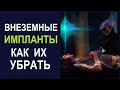 Внеземные ИМПЛАНТЫ. Как их убрать