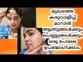 Sun Tan Removal Home Remedies In Malayalam/ Tan Removal Home Remedies/Sun Tan Removal Home Remedies