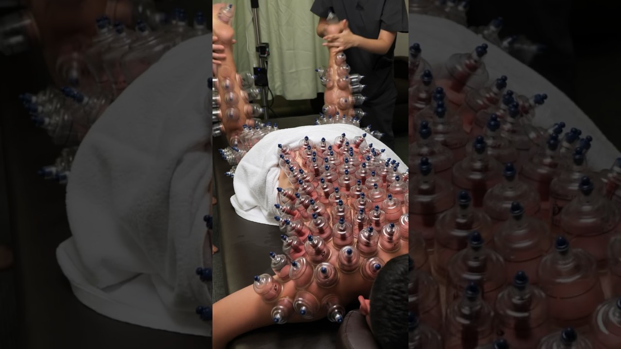 ASMR Japanese cupping massage therapy #asmr #cupping #cupping therapy #massage