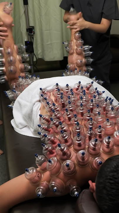 ASMR Japanese cupping massage therapy #asmr #cupping #cupping therapy #massage