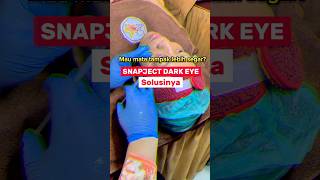 SNAPJECT DARK EYE solusi MATA PANDA 🐼 #matapanda #klinikecantikan #fyp #skinbooster