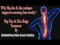 Slip disc  disc bulge treatment by chiropractor asad mirza