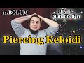 Piercing Keloidi - Dövme Muhabbetleri (Bölüm 11)