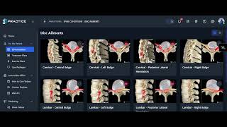 Spinal Decompression Explained