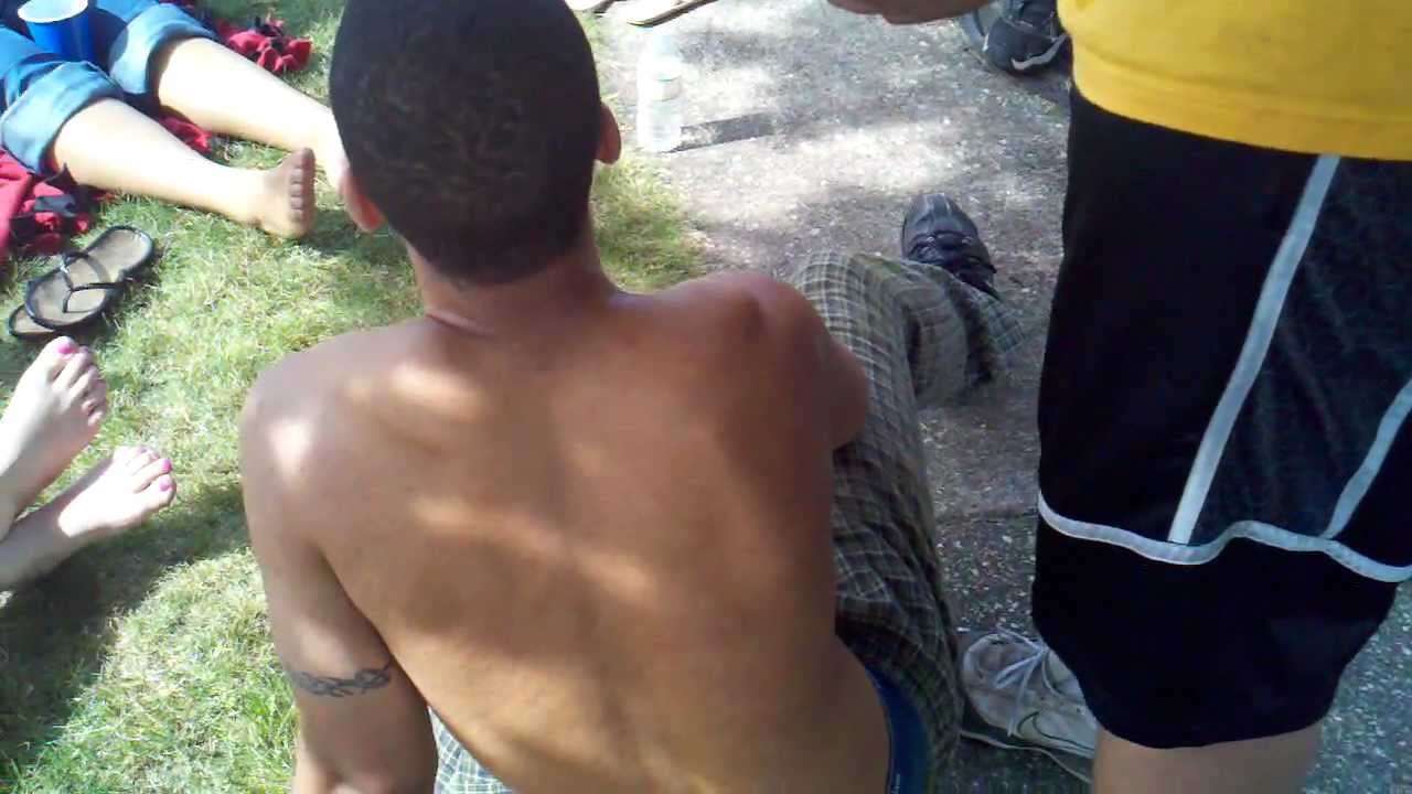 Popping the shoulder back into place! - YouTube