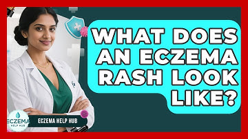 What Does An Eczema Rash Look Like? - Eczema Help Hub