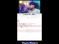 Shorts Live Trading on Crypto | Gold |Scalp with BSP Concept | #Live #Crypto #Gold #12-March-2025