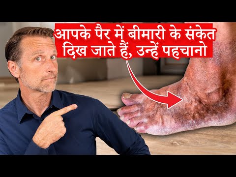 आपका पैर चेतावनी संकेत देता है - Dr. Eric Berg Hindi Sub