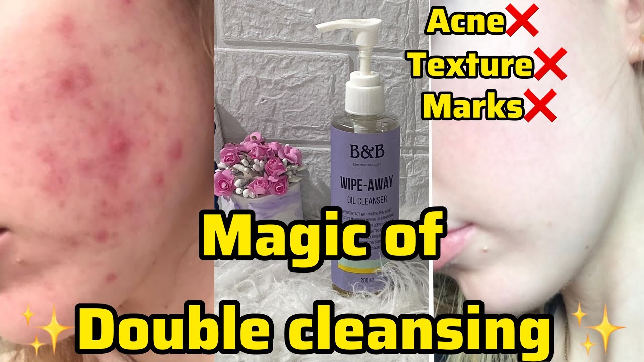 What is double cleansing?oil cleansing benefits start oil cleanser now
