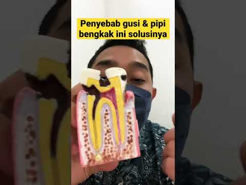SOLUSI PENYEBAB GUSI
