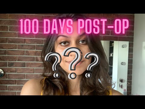 100 Days Post-Op Update Before Photos | Double Jaw Surgery