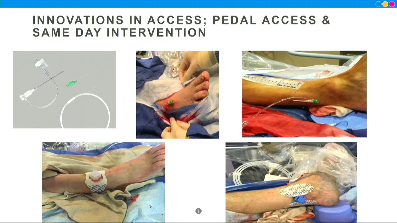 CVI 2019_Thursday 7/18_ Innovation in Vascular Disease_Kintur Sanghvi, MD interventional cardiology jobs