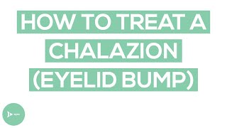Chalazion Eyelid Bump Treatment Exactly How To Treat A Chalazion