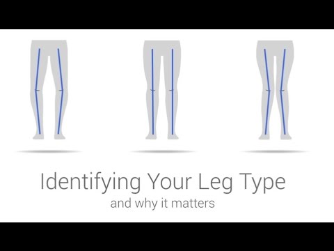 Video: How To Know If Your Legs Are Crooked Or Not